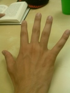Golden/Fibonocci's Number on a human hand.